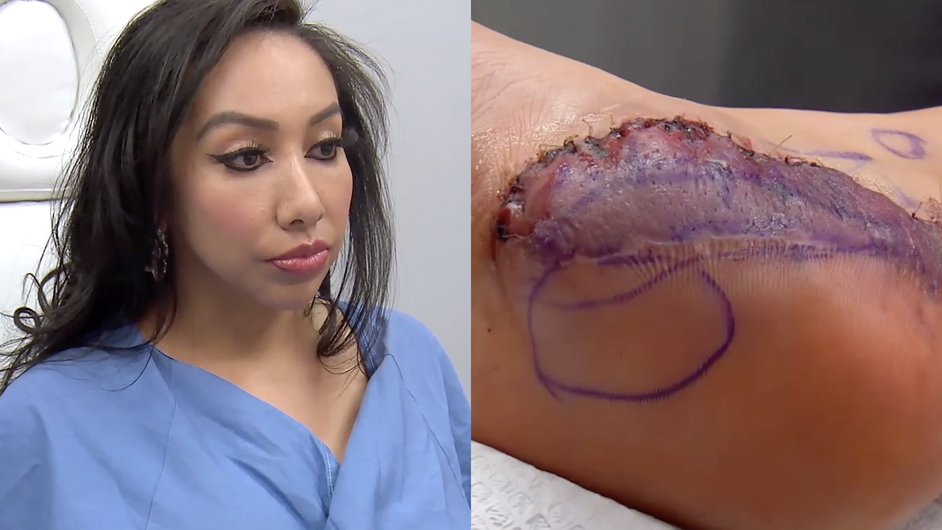 Botched' Features The Case Of A 'Mexican Tummy Tuck' And 'Grandma Boobs': 2  Surgeries That Went Horribly Wrong